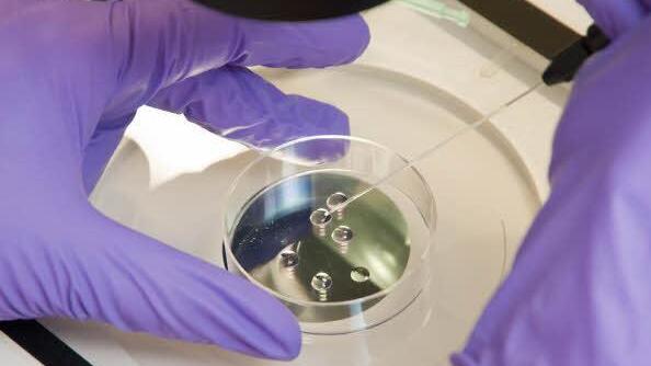 Die Eizellen werden zunächst in eine Art Gefrierschutzlösung gegeben, die den Zellen Wasser entzieht. Foto: Uni-Klinikum Erlangen