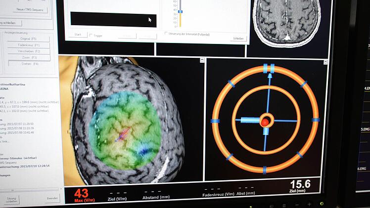 Durch die Neuronavigation kann man die betreffenden Areale exakt sehen und stimulieren. Foto: Ronald Rinklef