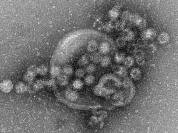 Elektronenmikroskopische Aufnahme von Noroviren. Das Norovirus breitet sich in diesem Winter stark aus. Allein in der Woche vor Weihnachten wurden in Deutschland 5289 Erkrankungen gemeldet, wie aus einer neuen Statistik des Robert-Koch-Instituts (RKI) hervorgeht. Foto: Gudrun Holland/RKI/Robert-Koch-Institut/dpa
