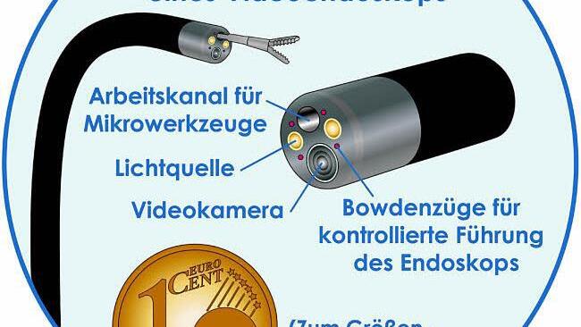 Schematische Darstellung eines Videoendoskops. Grafik: Felix Burda Stiftung